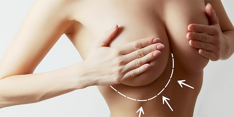 Breast Augmentation